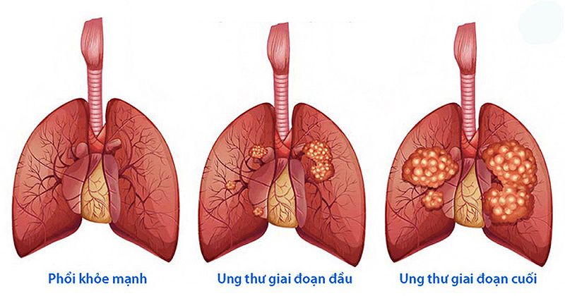 Điều kiện sức khoẻ đi xuất khẩu lao động Nhật Bản