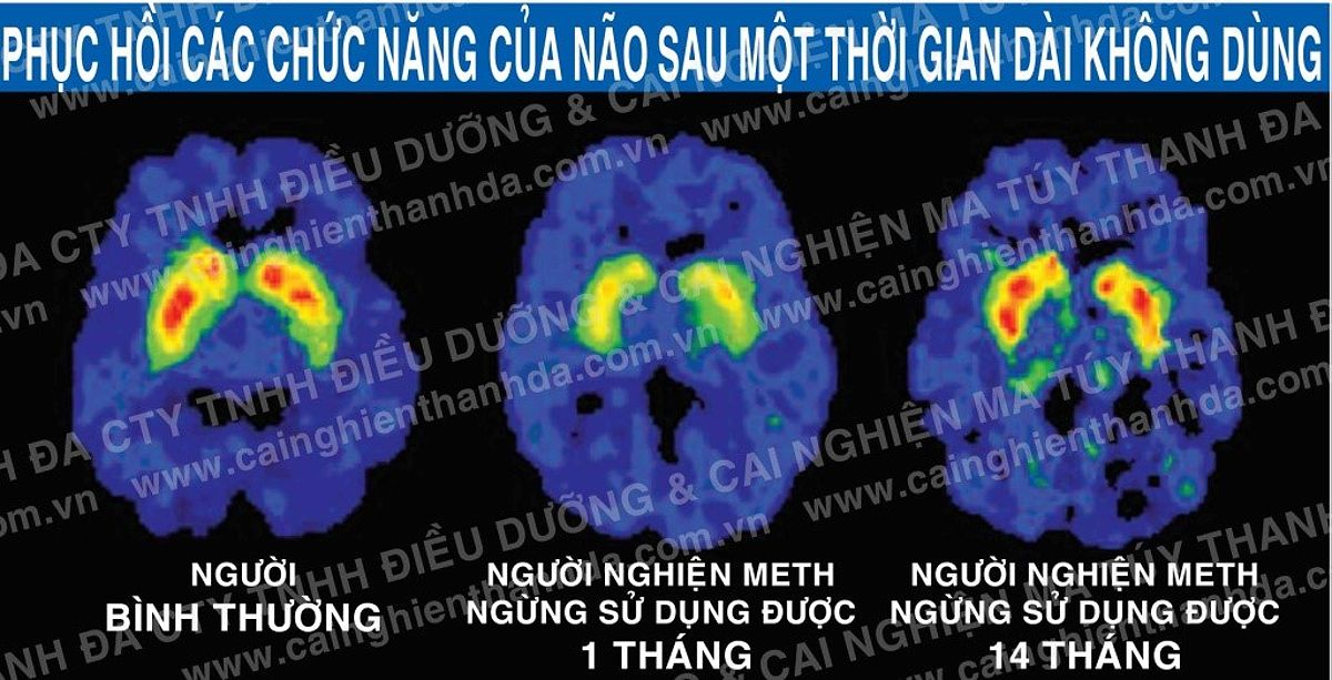 Hình ảnh về ma túy